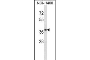CUTC Antibody (Center) (ABIN1538562 and ABIN2848511) western blot analysis in NCI- cell line lysates (35 μg/lane).