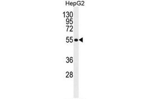 anti-Major Facilitator Superfamily Domain Containing 10 (MFSD10) (AA 252-282), (Middle Region) antibody
