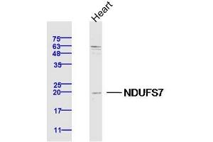 Image no. 2 for anti-NADH Dehydrogenase (Ubiquinone) Fe-S Protein 7, 20kDa (NADH-Coenzyme Q Reductase) (NDUFS7) (AA 101-160) antibody (ABIN1386126)