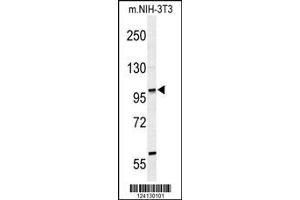Image no. 1 for anti-Zinc Finger Protein 451 (ZNF451) (AA 81-110), (N-Term) antibody (ABIN653589)