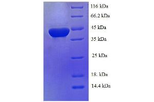 Protein expressed in E.