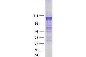 Image no. 1 for phosphodiesterase 4B, cAMP-Specific (PDE4B) (Transcript Variant D) protein (Myc-DYKDDDDK Tag) (ABIN2728514)