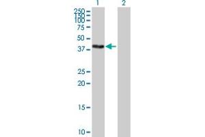Western Blot analysis of ZSCAN16 expression in transfected 293T cell line by ZSCAN16 MaxPab polyclonal antibody.