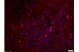 Image no. 7 for anti-Secreted Protein, Acidic, Cysteine-Rich (Osteonectin) (SPARC) (AA 101-200) antibody (ABIN738141)