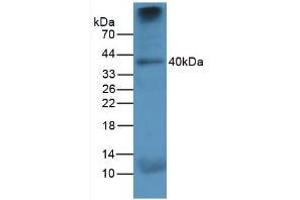 Image no. 2 for anti-Cathepsin K (CTSK) (AA 115-329) antibody (ABIN3201849)