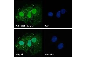 Image no. 6 for anti-Intraflagellar Transport 88 Homolog (IFT88) (C-Term) antibody (ABIN185555)