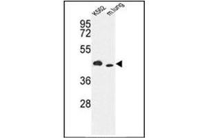 Image no. 1 for anti-Inositol-Trisphosphate 3-Kinase A (ITPKA) (AA 353-382), (C-Term) antibody (ABIN360691)