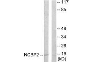 Image no. 1 for anti-Nuclear Cap Binding Protein Subunit 2 (NCBP2) (AA 10-59) antibody (ABIN1533766)
