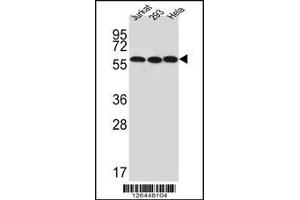 Image no. 1 for anti-UTP6, Small Subunit (SSU) Processome Component, Homolog (UTP6) (N-Term) antibody (ABIN2493605)