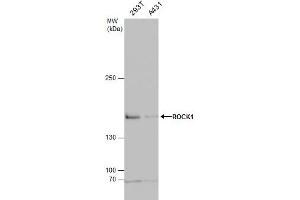 Image no. 6 for anti-rho-Associated, Coiled-Coil Containing Protein Kinase 1 (ROCK1) (N-Term) antibody (ABIN2856887)