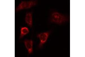 Image no. 3 for anti-Myosin IXB (MYO9B) antibody (ABIN6257337)