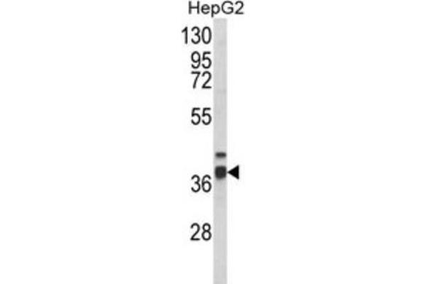 PECI/ECI2 anticorps
