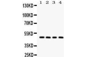 Image no. 1 for anti-serpin Peptidase Inhibitor, Clade A (Alpha-1 Antiproteinase, Antitrypsin), Member 1 (SERPINA1) (AA 211-411) antibody (ABIN3043431)