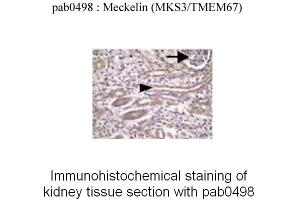 Image no. 3 for anti-Transmembrane Protein 67 (TMEM67) (C-Term) antibody (ABIN347657)