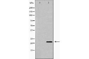 Image no. 2 for anti-Interleukin 18 (IL18) (Internal Region) antibody (ABIN6262541)