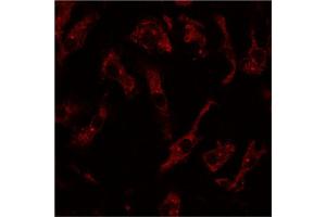 Image no. 1 for anti-RAB8A, Member RAS Oncogene Family (RAB8A) (C-Term) antibody (ABIN6254181)