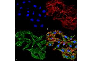 Image no. 1 for anti-WD Repeat and FYVE Domain Containing 3 (WDFY3) (AA 533-544) antibody (HRP) (ABIN5066348)