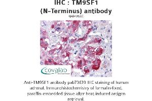 Image no. 1 for anti-Transmembrane 9 Superfamily Member 1 (TM9SF1) (N-Term) antibody (ABIN1740139)