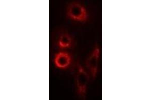 Image no. 2 for anti-Second Mitochondria-Derived Activator of Caspase (DIABLO) antibody (ABIN3198321)
