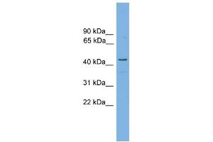 anti-Retinol Dehydrogenase 16 (All-Trans) (RDH16) (Middle Region) antibody