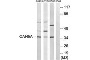 Image no. 1 for anti-Carbonic Anhydrase VA (CA5A) (AA 171-220) antibody (ABIN1534728)