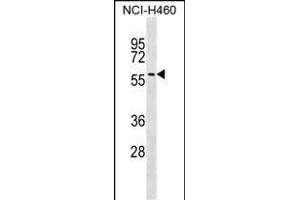 UGT2A3 Antibody (Center) (ABIN1538310 and ABIN2849300) western blot analysis in NCI- cell line lysates (35 μg/lane).