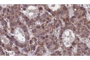 Image no. 1 for anti-G Protein-Coupled Receptor 77 (GPR77) (C-Term) antibody (ABIN6256825)