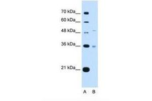 Image no. 2 for anti-Uronyl-2-Sulfotransferase (UST) (AA 301-350) antibody (ABIN321131)