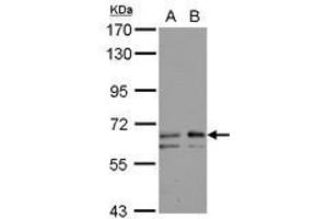 Image no. 2 for anti-UDP-N-Acetyl-alpha-D-Galactosamine:polypeptide N-Acetylgalactosaminyltransferase 2 (GalNAc-T2) (GALNT2) (AA 272-523) antibody (ABIN1498370)