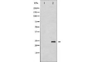 Image no. 1 for anti-Caveolin 1, Caveolae Protein, 22kDa (CAV1) (pTyr14) antibody (ABIN6255810)