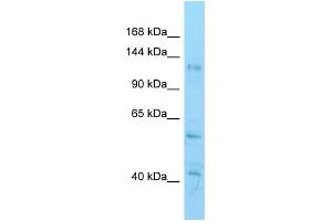 Image no. 2 for anti-Histone Deacetylase 6 (HDAC6) (C-Term) antibody (ABIN2780739)