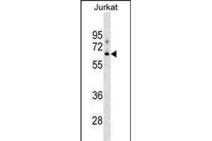 XYLB antibody  (N-Term)