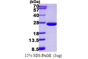 Image no. 1 for ADP-Ribosylation Factor-Like 3 (ARL3) (AA 1-182) protein (His tag) (ABIN667566)
