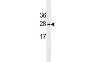 Image no. 4 for anti-Erythropoietin (EPO) (AA 20-48) antibody (ABIN3030867)