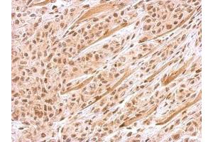 BRIP1 antibody  (N-Term)