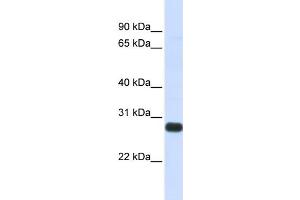 Image no. 1 for anti-serine Peptidase Inhibitor, Kunitz Type, 2 (SPINT2) (Middle Region) antibody (ABIN2773946)