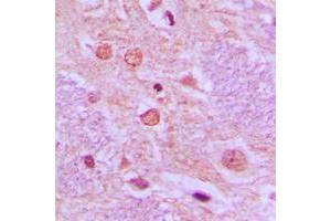 Image no. 1 for anti-Synovial Sarcoma Translocation, Chromosome 18 (SS18) (N-Term) antibody (ABIN2707755)