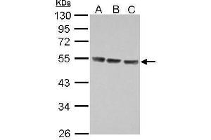 WB Image Sample (30 ug of whole cell lysate) A: Jurkat B: Raji C: K562 10% SDS PAGE antibody diluted at 1:5000