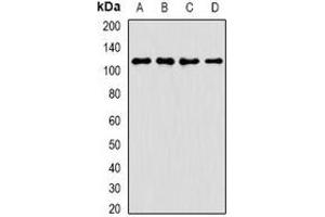 Image no. 2 for anti-Ankyrin Repeat Domain 52 (ANKRD52) antibody (ABIN2966418)
