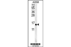 Image no. 2 for anti-Golgi Transport 1A (GOLT1A) (AA 103-130), (C-Term) antibody (ABIN651799)