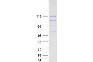 Image no. 1 for Salt-Inducible Kinase 2 (SIK2) protein (Myc-DYKDDDDK Tag) (ABIN2732053)