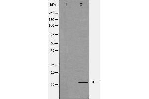 Image no. 2 for anti-Eukaryotic Translation Initiation Factor 5A (EIF5A) (Internal Region) antibody (ABIN6261503)