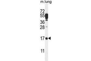Image no. 1 for anti-Chromosome 14 Open Reading Frame 126 (C14orf126) (AA 143-172), (C-Term) antibody (ABIN950751)