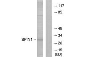 Image no. 1 for anti-Spindlin 1 (SPIN1) (AA 111-160) antibody (ABIN1534224)