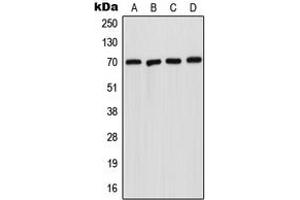 Image no. 1 for anti-Sphingomyelin phosphodiesterase 1, Acid Lysosomal (SMPD1) (Center) antibody (ABIN2705389)