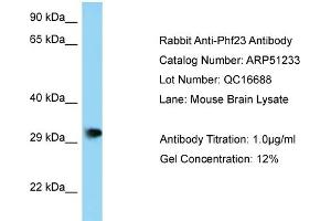 Image no. 1 for anti-PHD Finger Protein 23 (PHF23) (N-Term) antibody (ABIN2784473)
