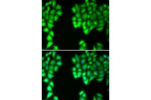 Image no. 2 for anti-Mucosa Associated Lymphoid Tissue Lymphoma Translocation Gene 1 (MALT1) antibody (ABIN3023032)
