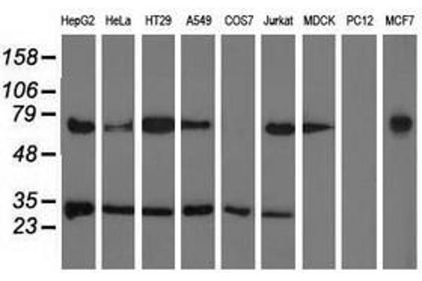 anti-Pyrroline-5-Carboxylate Reductase Family, Member 2 (PYCR2) antibody
