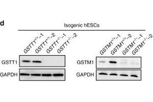 Image no. 6 for anti-Glutathione S-Transferase theta 1 (GSTT1) (full length) antibody (ABIN2856663)