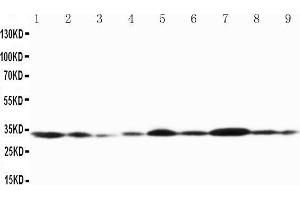 Image no. 1 for anti-Gap Junction Protein, beta 1, 32kDa (GJB1) (AA 215-231), (Middle Region) antibody (ABIN3042611)